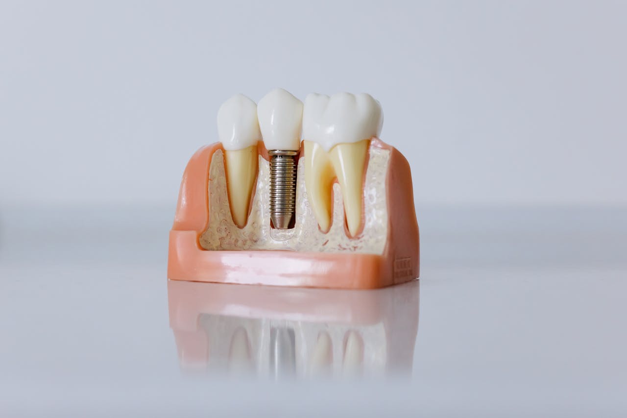 Jak często chodzić do dentysty?
